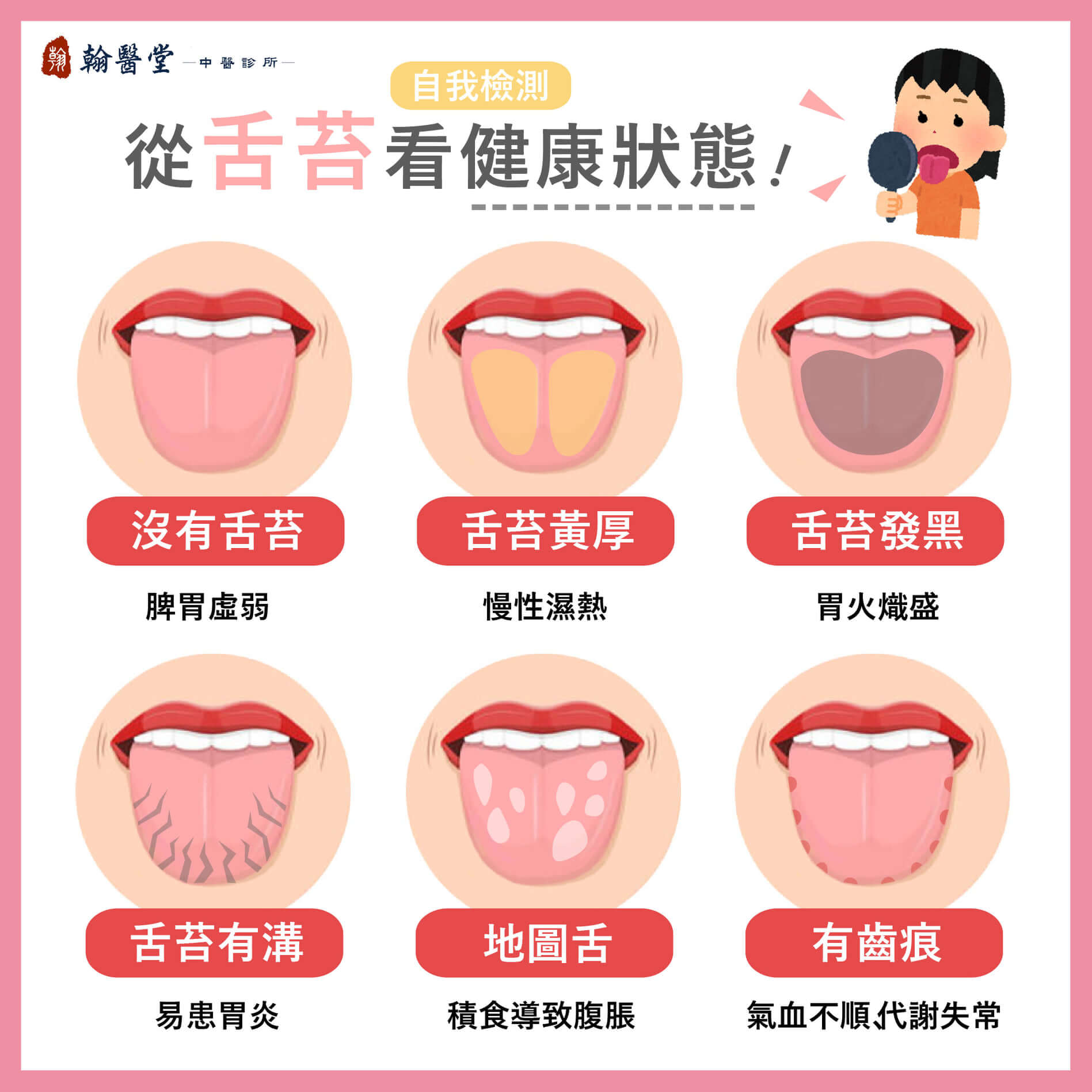 舌苔健康檢測-翰醫堂中醫診所