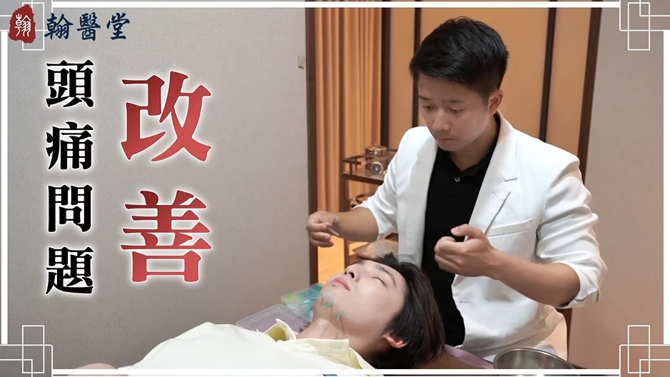 美顏針不只變美？改善睡眠、頭痛、氣色一次搞定！陳祖熙中醫師分享案例