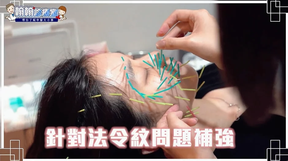 你也有素顏焦慮嗎？翰醫堂楊雅淳中醫師：美顏針打造原生好膚質，助你回歸自信！