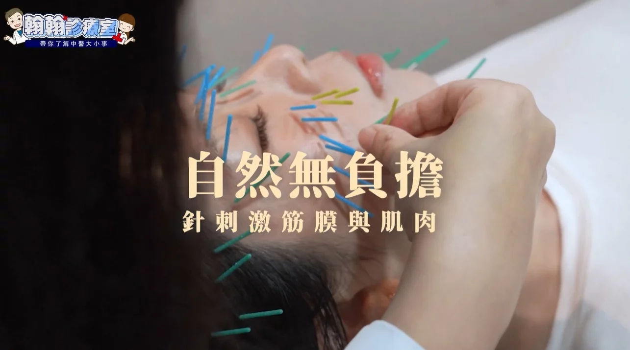 顏面神經失調有解！杜冠誼中醫師解析「美顏針」，免動刀改善神經麻痹、大小臉、法令紋！