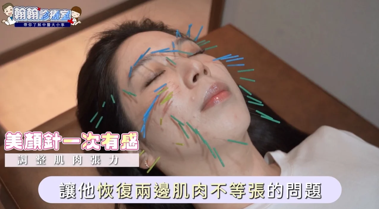 顏面神經失調有解！杜冠誼中醫師解析「美顏針」，免動刀改善神經麻痹、大小臉、法令紋！