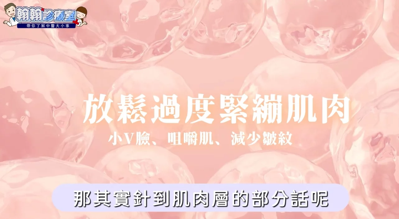 顏面神經失調有解！杜冠誼中醫師解析「美顏針」，免動刀改善神經麻痹、大小臉、法令紋！