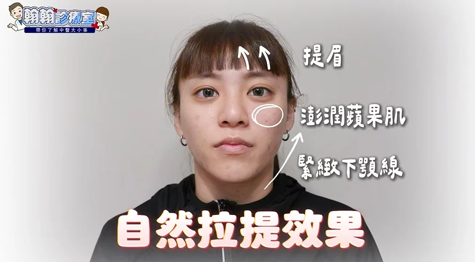 黑眼圈、大小臉、臉部浮腫好困擾？高雄陳炳曄中醫師：中醫美顏針助你找回自然好氣色！