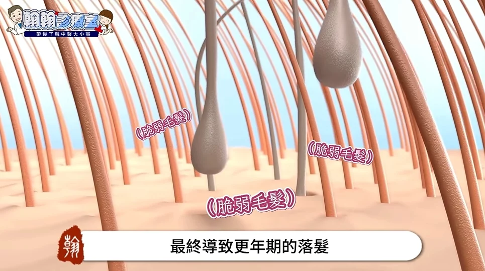 更年期掉髮怎麼救？黃馨葦中醫師：揭秘4大體質，對應調理頭髮細軟、綁髮變少，洗頭狂掉不再是老化，是氣血失衡的警訊！